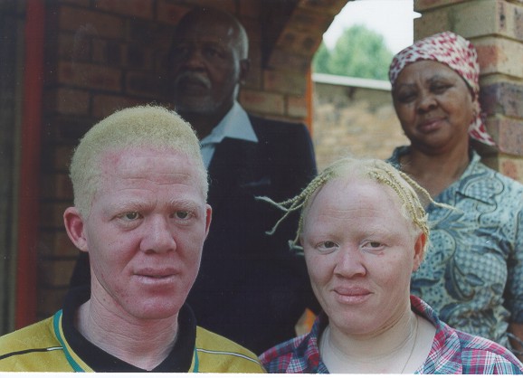 negros-albinos.jpg